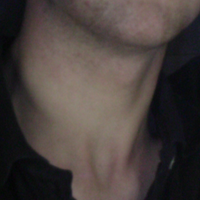 profile_Neck