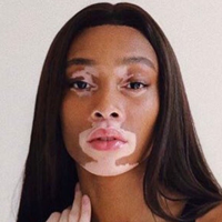 Winnie Harlow tipe kepribadian MBTI image