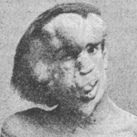 Joseph Merrick mbtiパーソナリティタイプ image