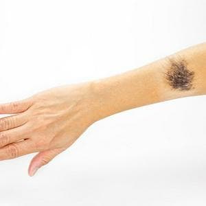 profile_Show Their Scar Proudly